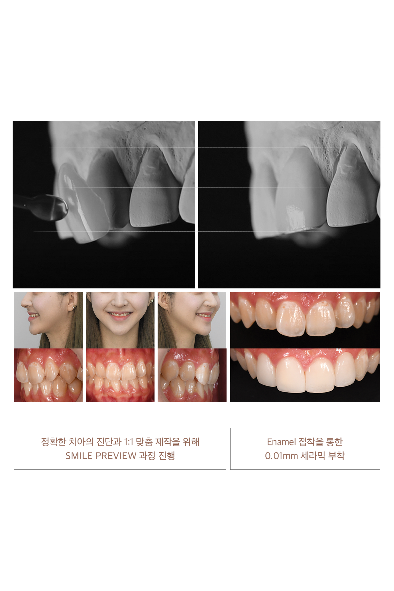 smilepreview