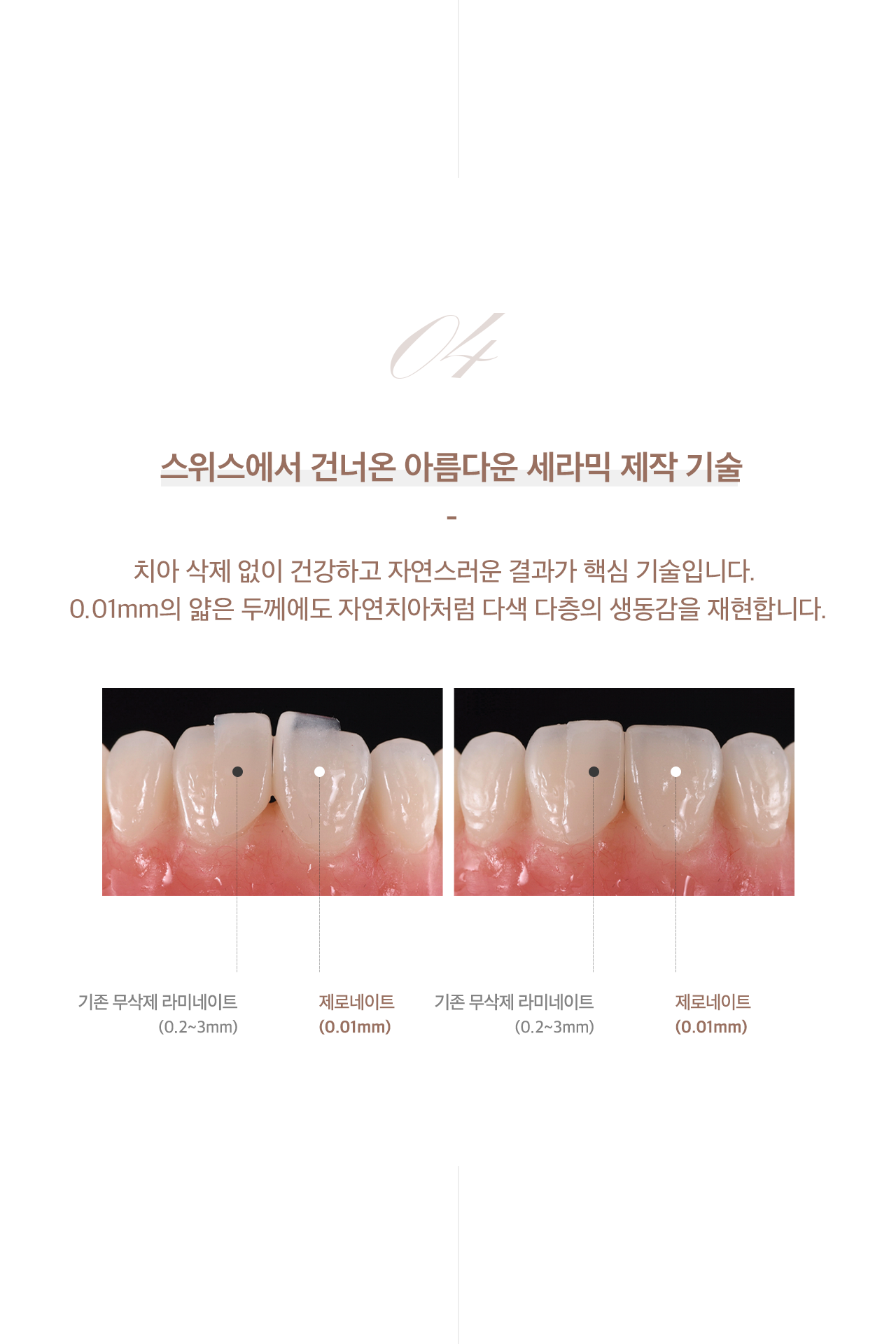 기존vs제로