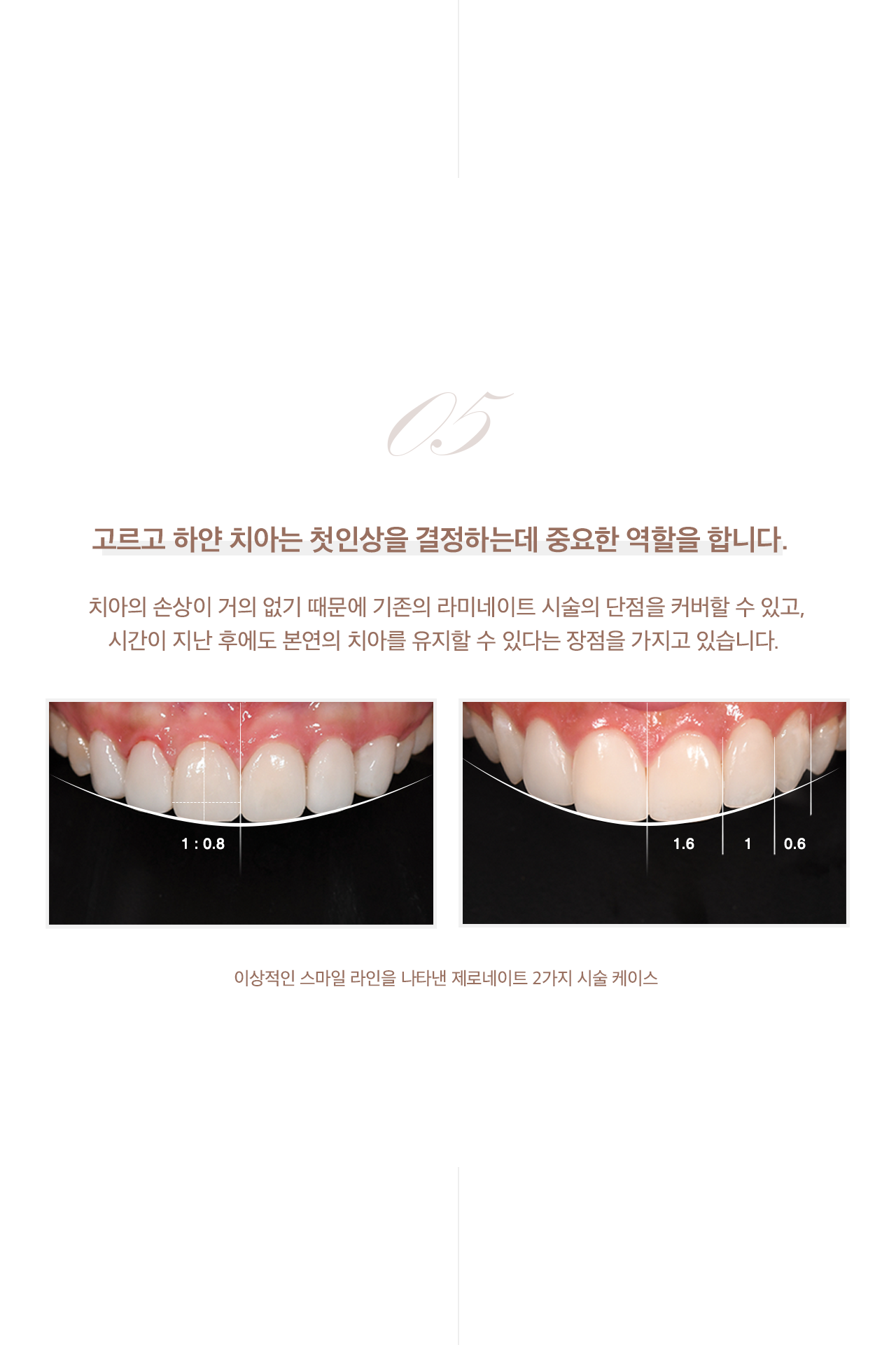 첫인상