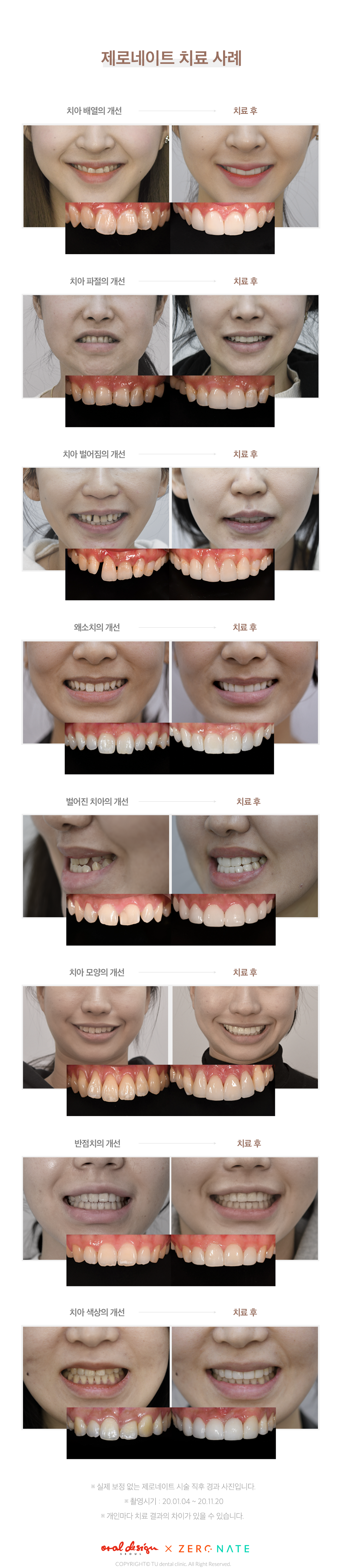 전후사진